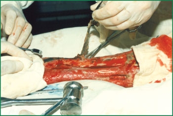 恒峰g22(国际)官网入口-每天有惊喜