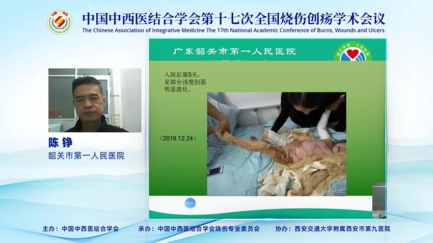 恒峰g22(国际)官网入口-每天有惊喜