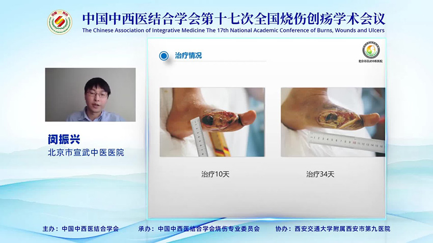 恒峰g22(国际)官网入口-每天有惊喜