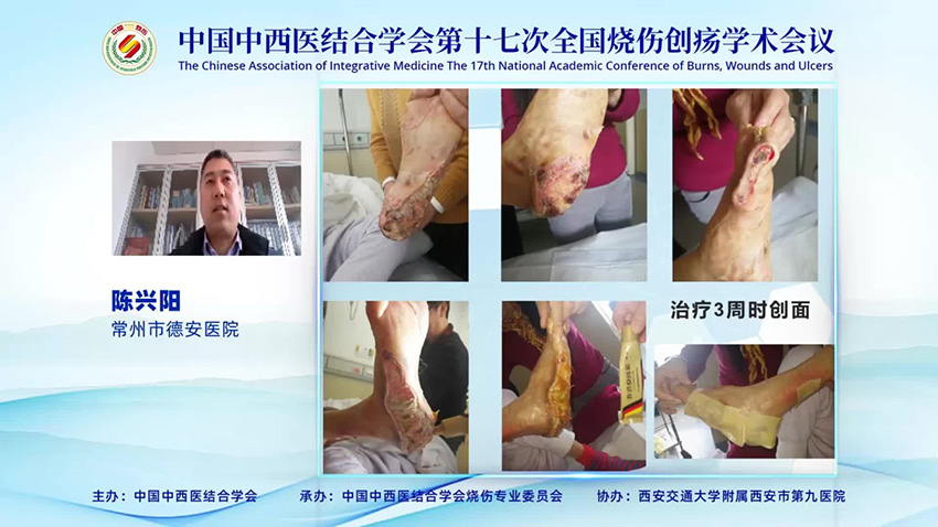 恒峰g22(国际)官网入口-每天有惊喜