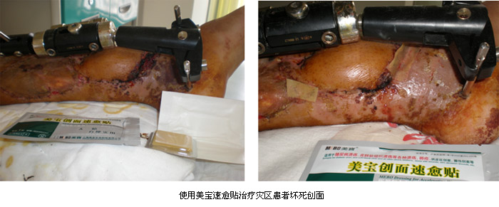 恒峰g22(国际)官网入口-每天有惊喜