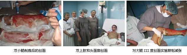 恒峰g22(国际)官网入口-每天有惊喜