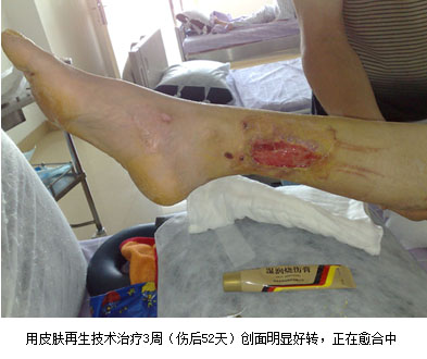 恒峰g22(国际)官网入口-每天有惊喜