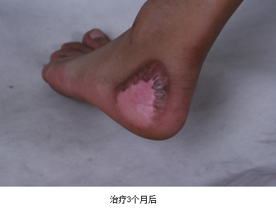 恒峰g22(国际)官网入口-每天有惊喜