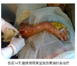 恒峰g22(国际)官网入口-每天有惊喜