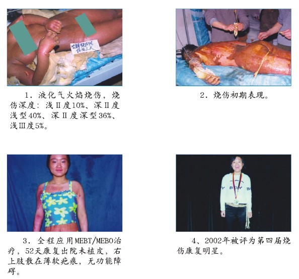 恒峰g22(国际)官网入口-每天有惊喜