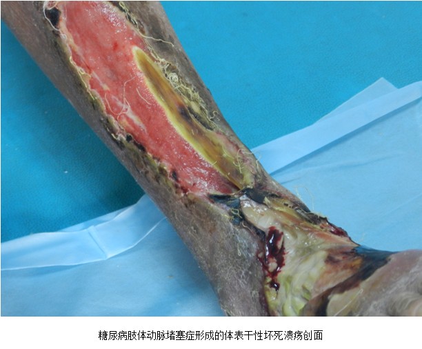 恒峰g22(国际)官网入口-每天有惊喜