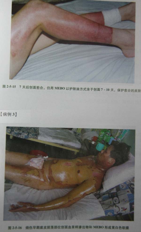 201131142537634