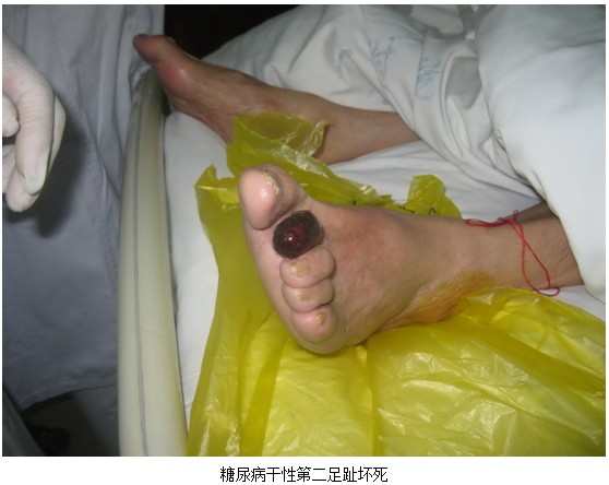 2012611133440174